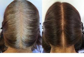 5N and toned with SEQ 06N 07N